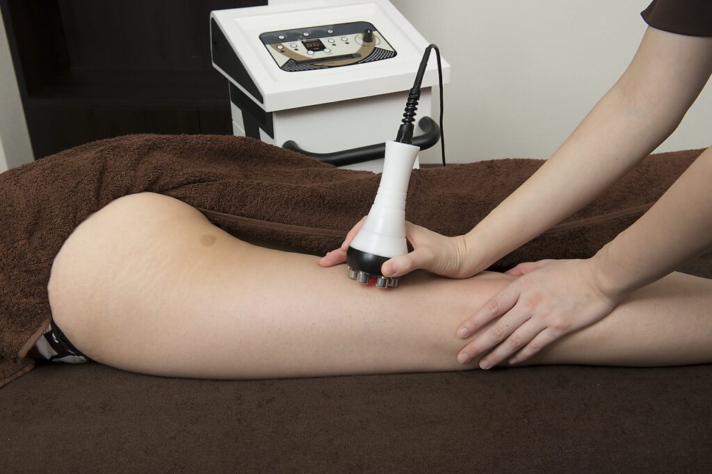 ハイパナイフを使って大腿部の脂肪を減少させる